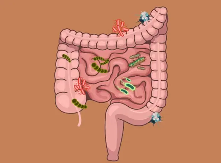 The Power of Gut Health: How Your Microbiome Influences Your Well-Being